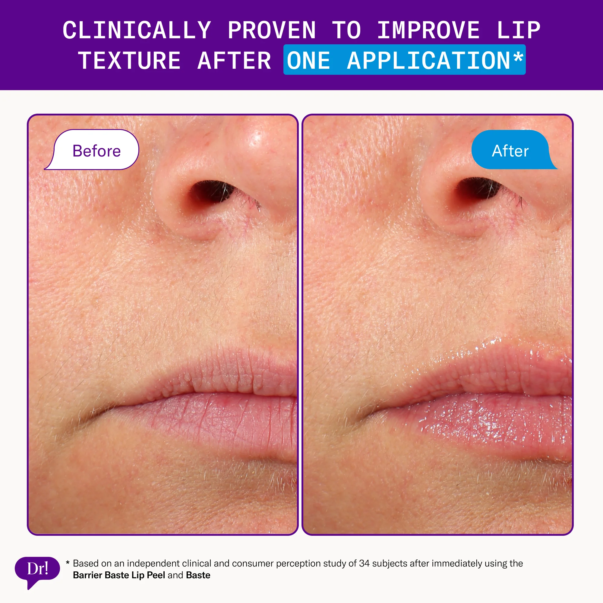 Barrier Baste Lip Peel - Image 3