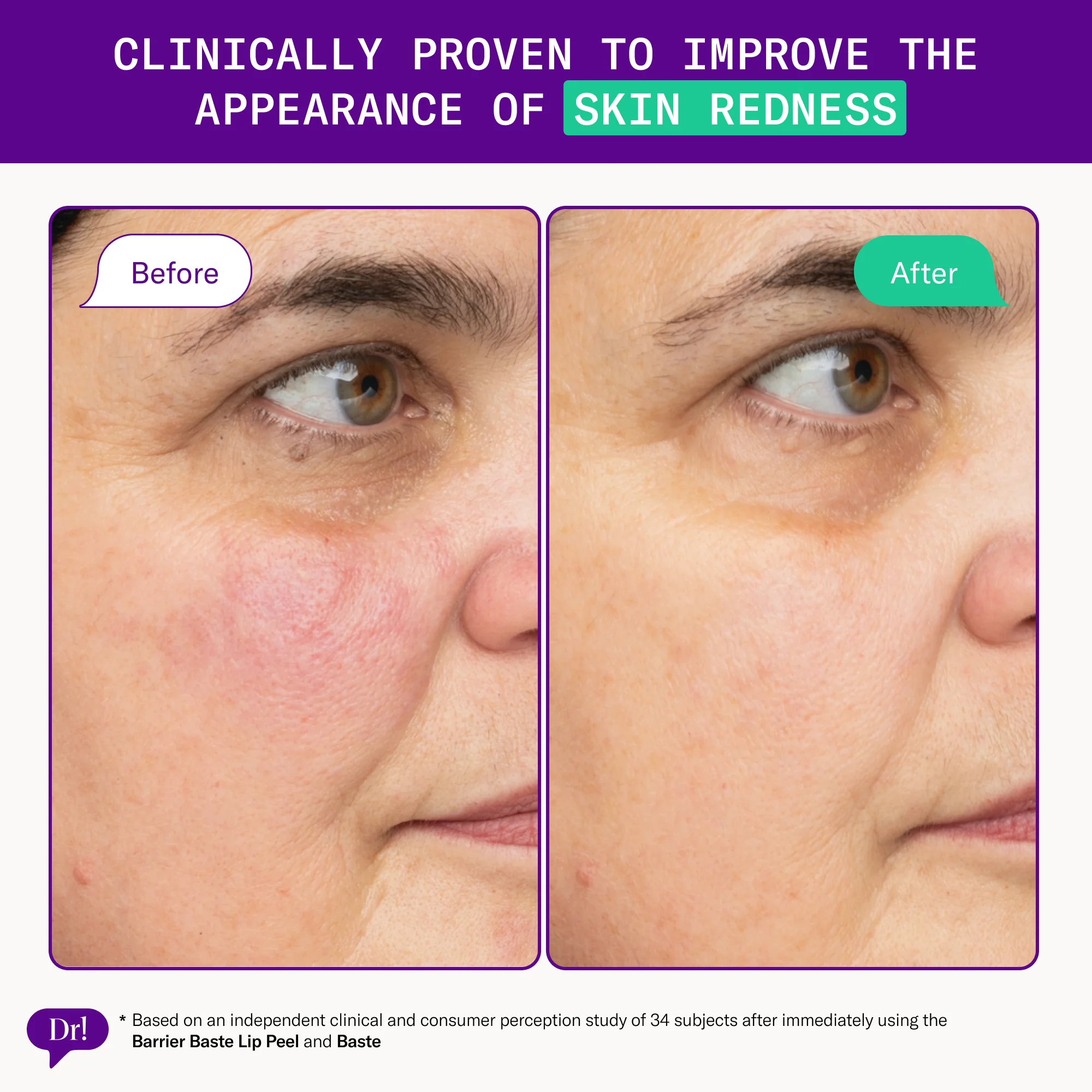 Left Un-Red Reducer Serum - Image 3